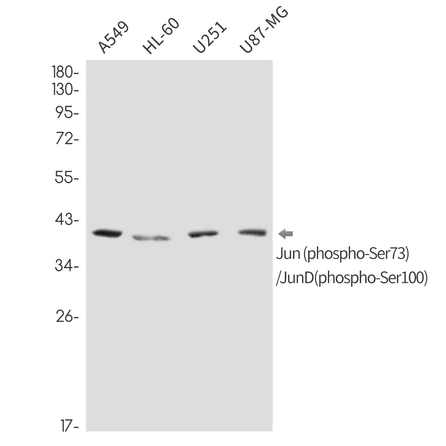 Phospho-c-Jun/JunD (Ser73/Ser100) Rabbit Monoclonal Antibody