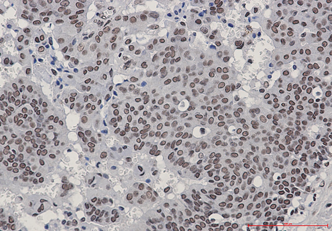 [KO] Phospho-HSF1 (Ser303/Ser307) Rabbit mAb