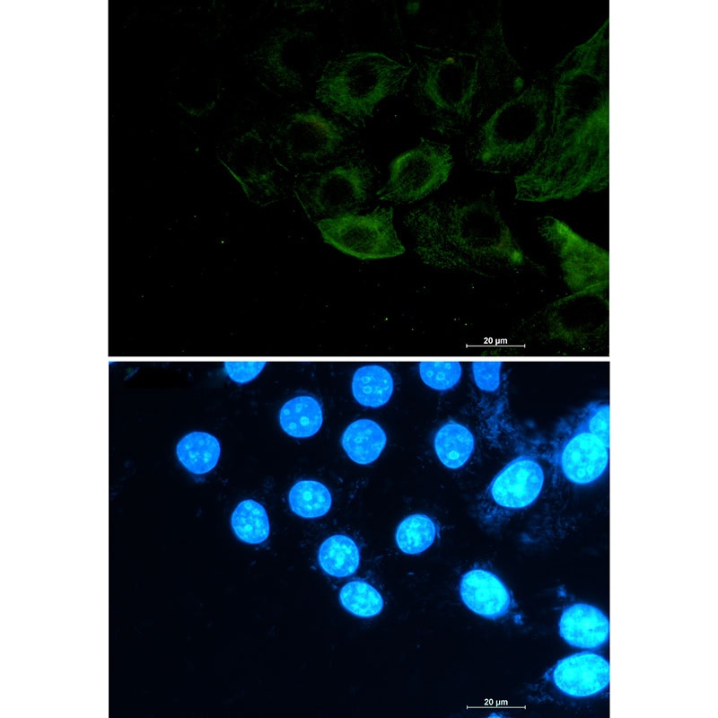 Phospho-Filamin A/B (Ser2152/Ser2107) Rabbit mAb