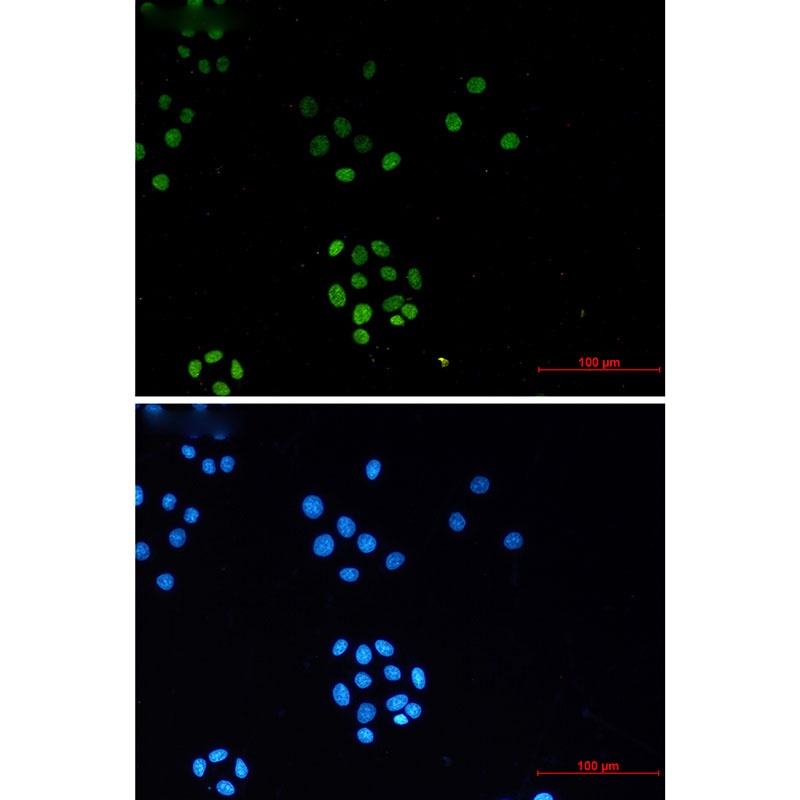 TriMethyl-Histone H3 (Lys27) Rabbit mAb