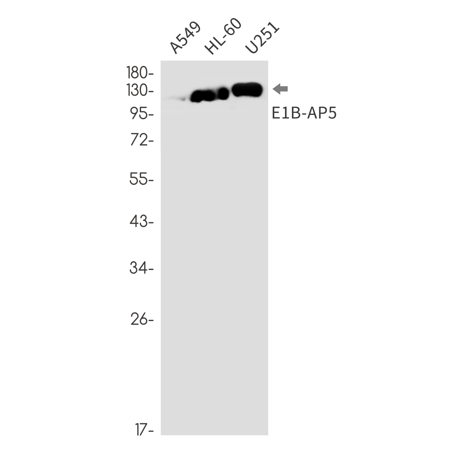E1B AP5 Rabbit mAb