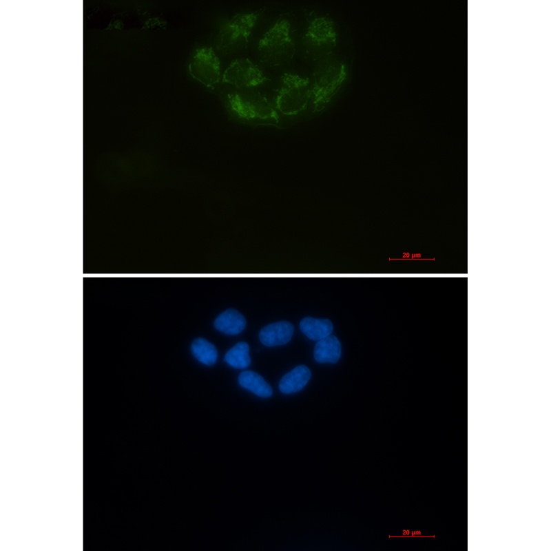 [KD] CD147 Rabbit mAb