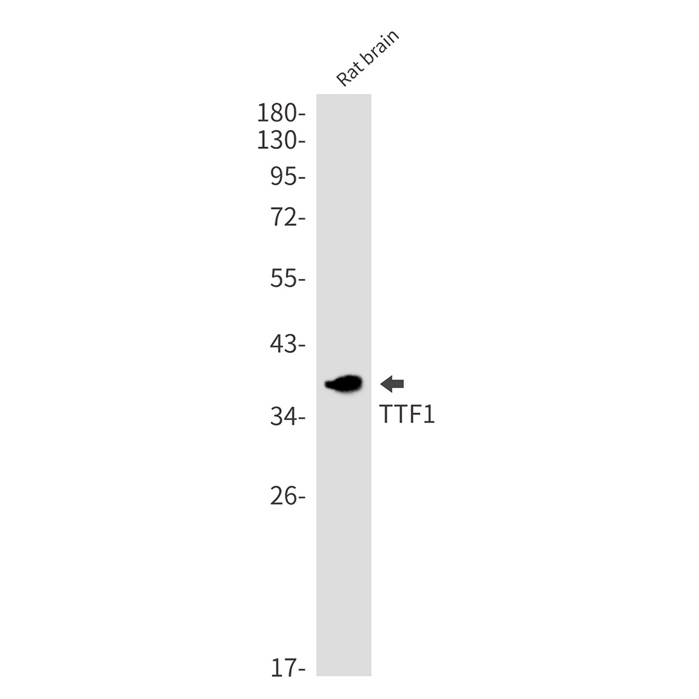 [KO] Thyroid Transcription Factor 1 Rabbit mAb