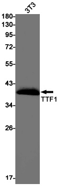 [KO] Thyroid Transcription Factor 1 Rabbit mAb