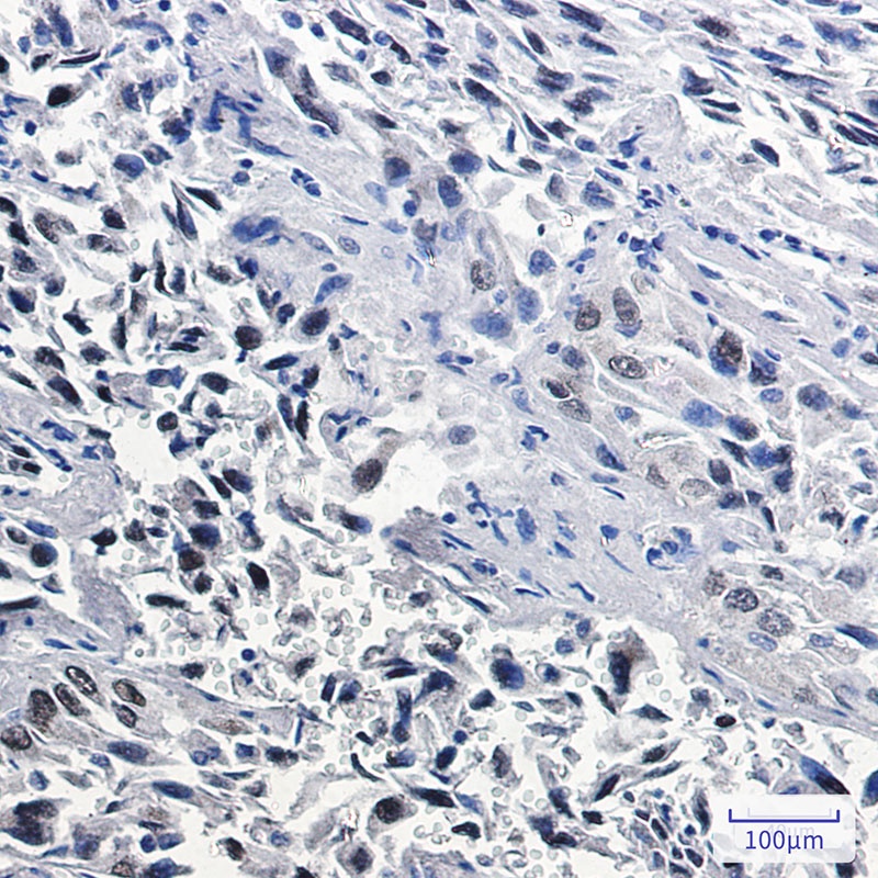 [KO] Thyroid Transcription Factor 1 Rabbit mAb