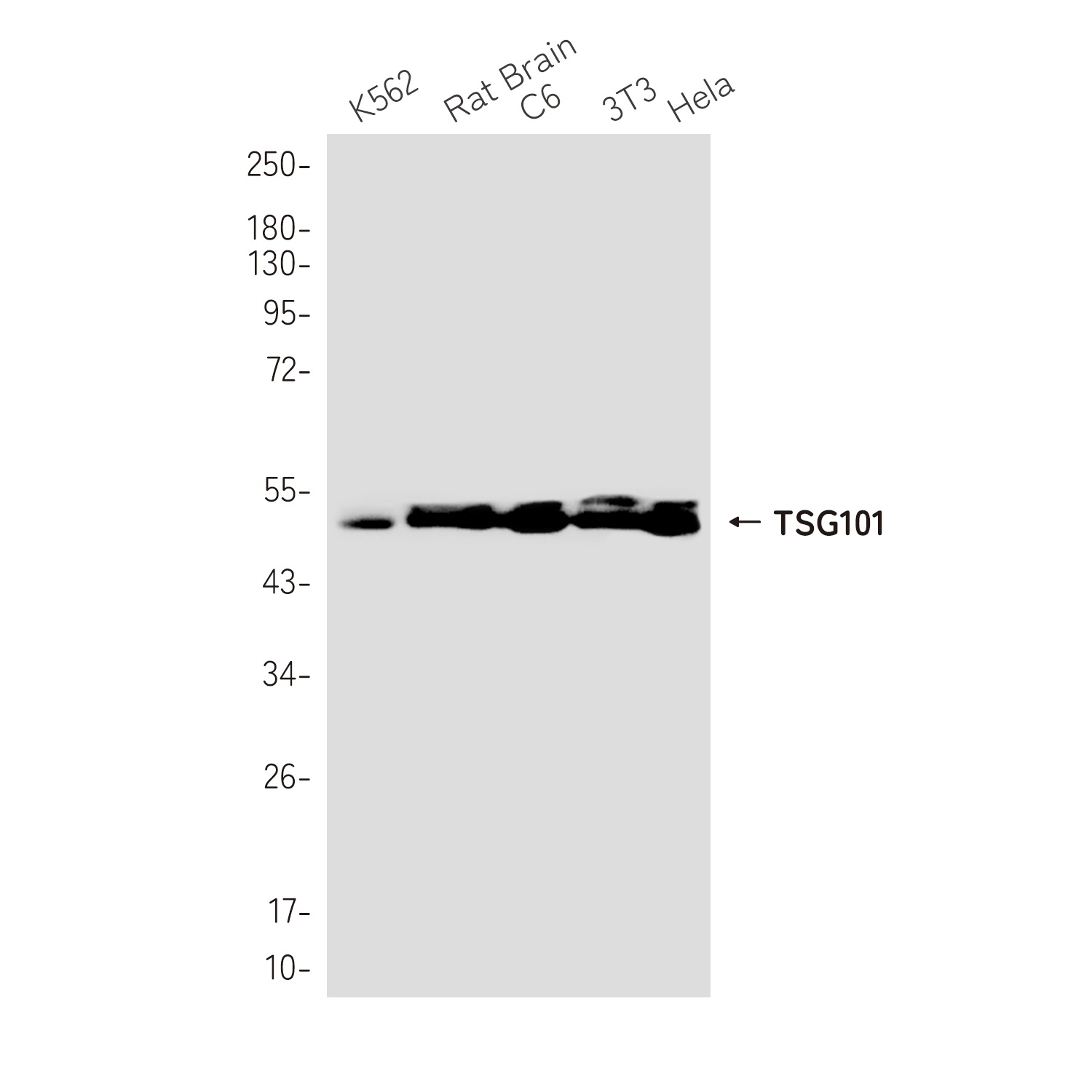 TSG101 Rabbit Monoclonal Antibody