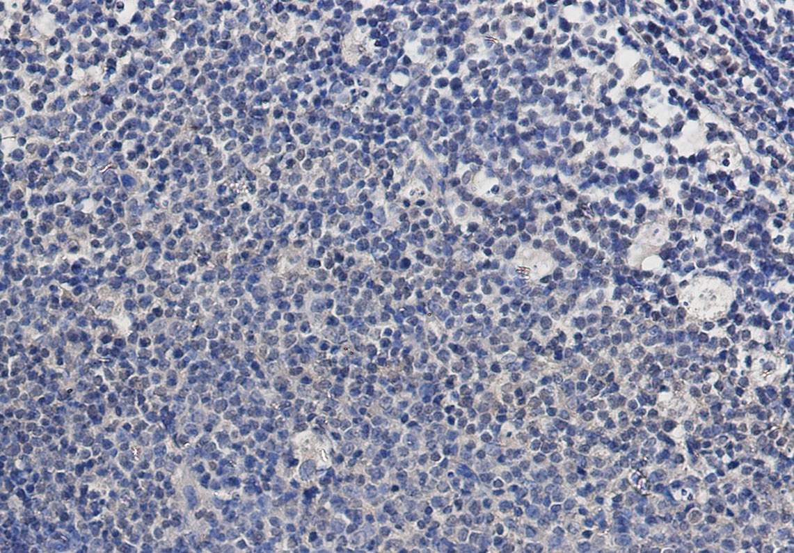 TSG101 Rabbit Monoclonal Antibody