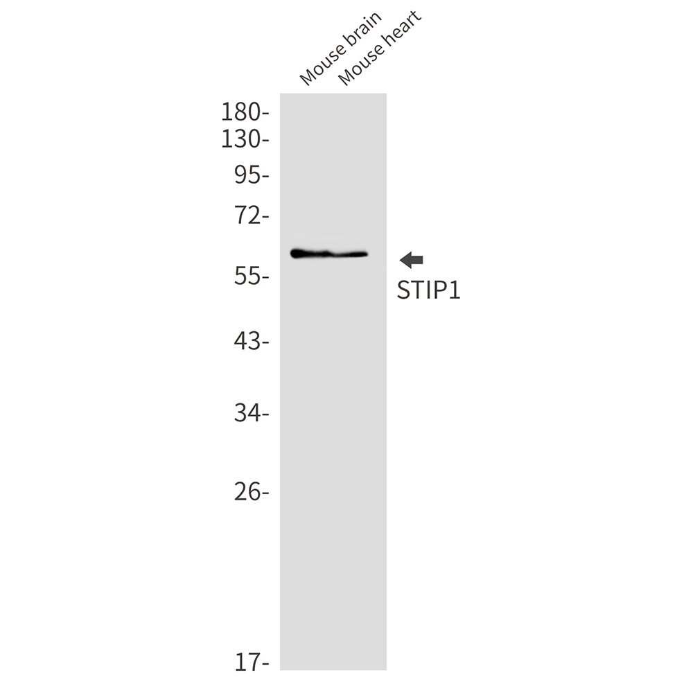 STIP1/STI1 Rabbit Monoclonal Antibody