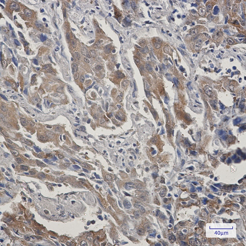 STIP1/STI1 Rabbit Monoclonal Antibody