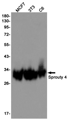Sprouty 4/Spry-4 Rabbit Monoclonal Antibody