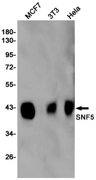 SNF5/SMARCB1 Rabbit Monoclonal Antibody