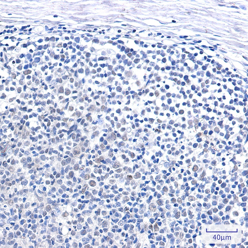 SNF5/SMARCB1 Rabbit Monoclonal Antibody