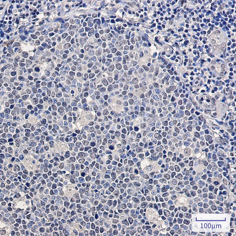 SF2 Rabbit Monoclonal Antibody