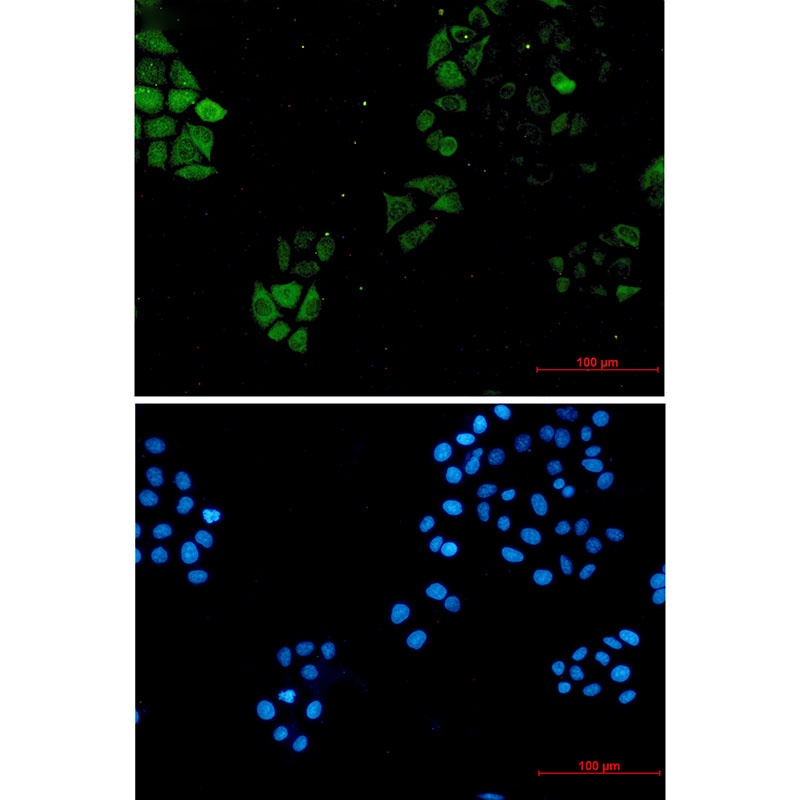 S100A4 Rabbit Monoclonal Antibody