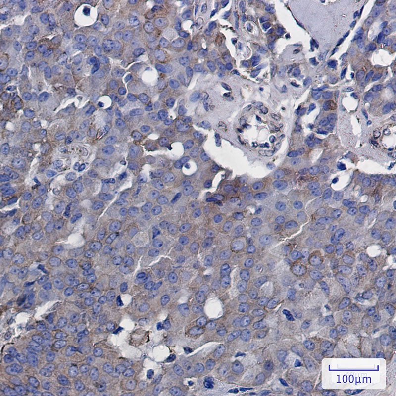 [KO] Rab5 Rabbit mAb