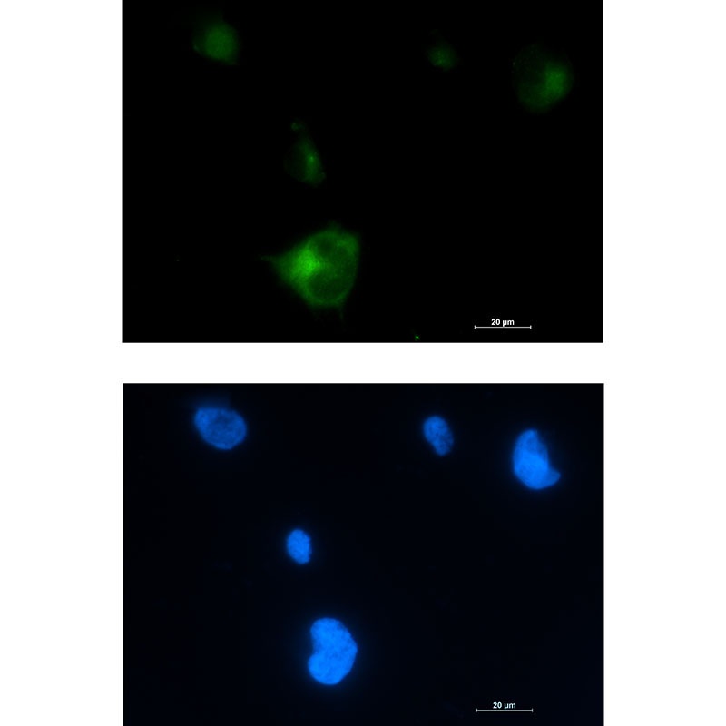 [KD] Rab5 Rabbit mAb