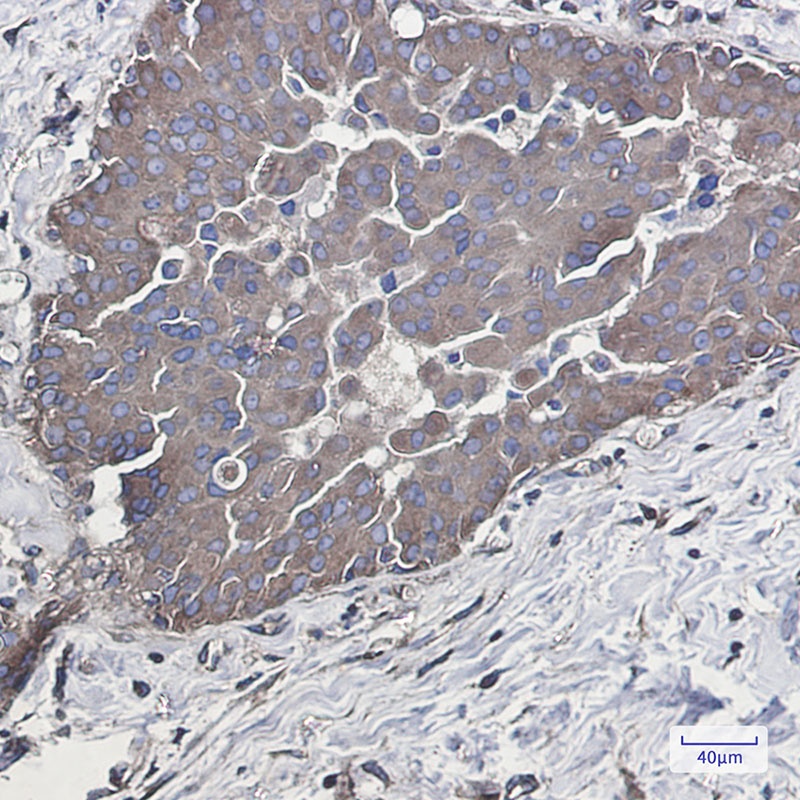 [KD] Rab5 Rabbit mAb