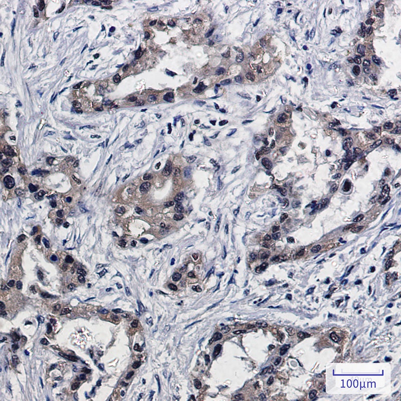 [KO] PSMB10 Rabbit mAb