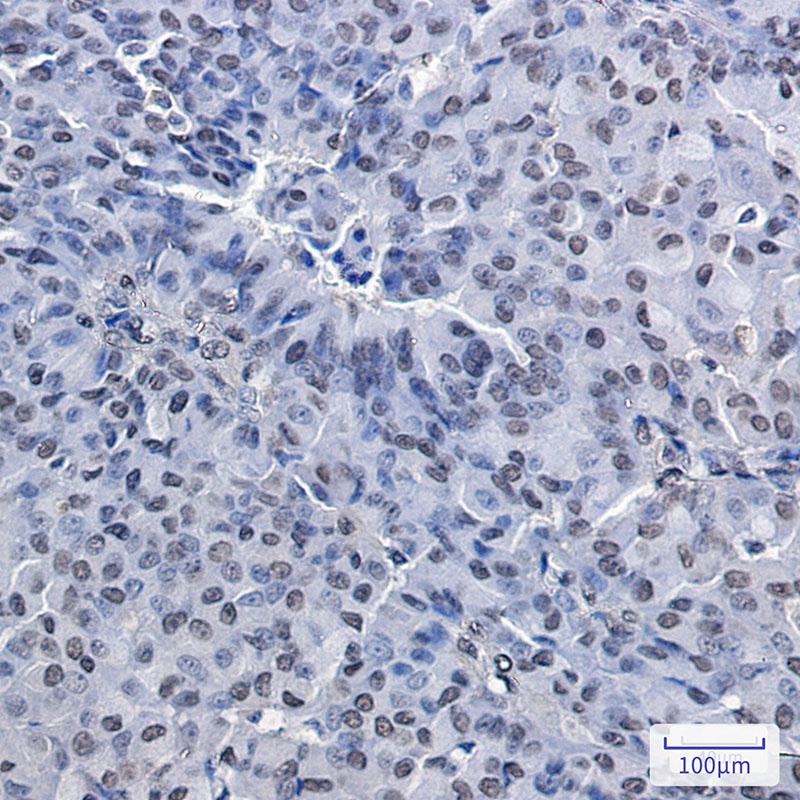 [KO] PRMT1 Rabbit mAb
