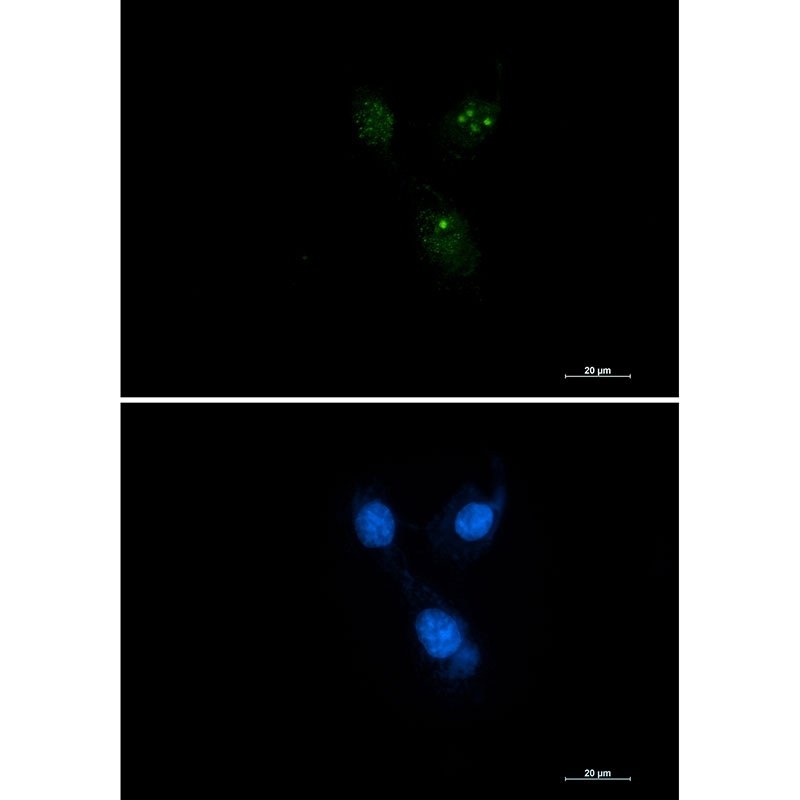 [KD] Presenilin 1 Rabbit mAb