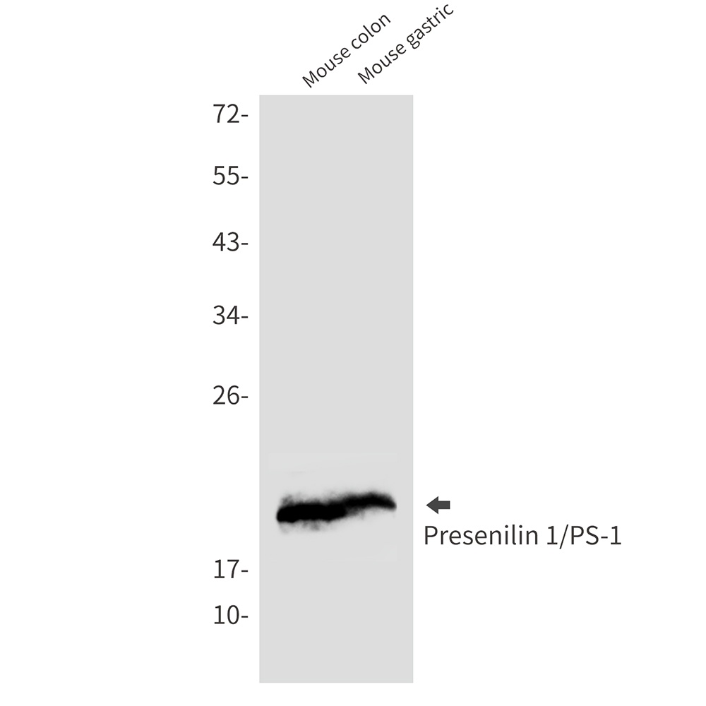 [KD] Presenilin 1 Rabbit mAb
