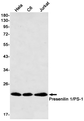 [KD] Presenilin 1 Rabbit mAb