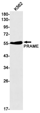 [KO] PRAME Rabbit mAb
