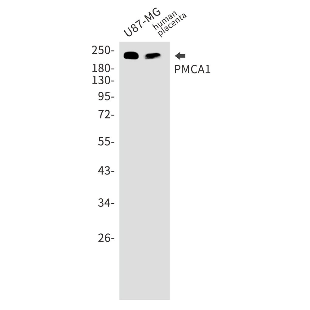 PMCA1 Rabbit Monoclonal Antibody
