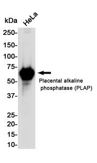 [KO] Placental Alkaline Phosphatase Rabbit mAb