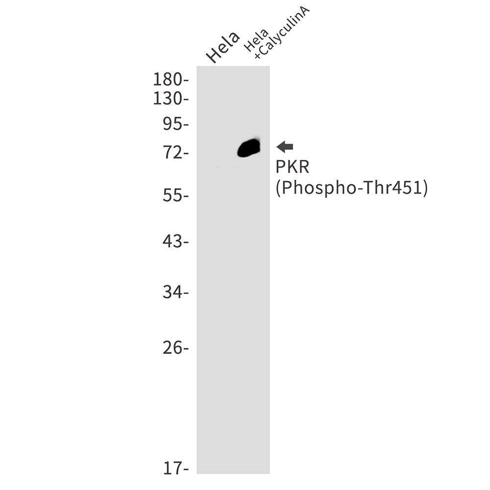 [KO] Phospho-PKR (Thr451) Rabbit mAb