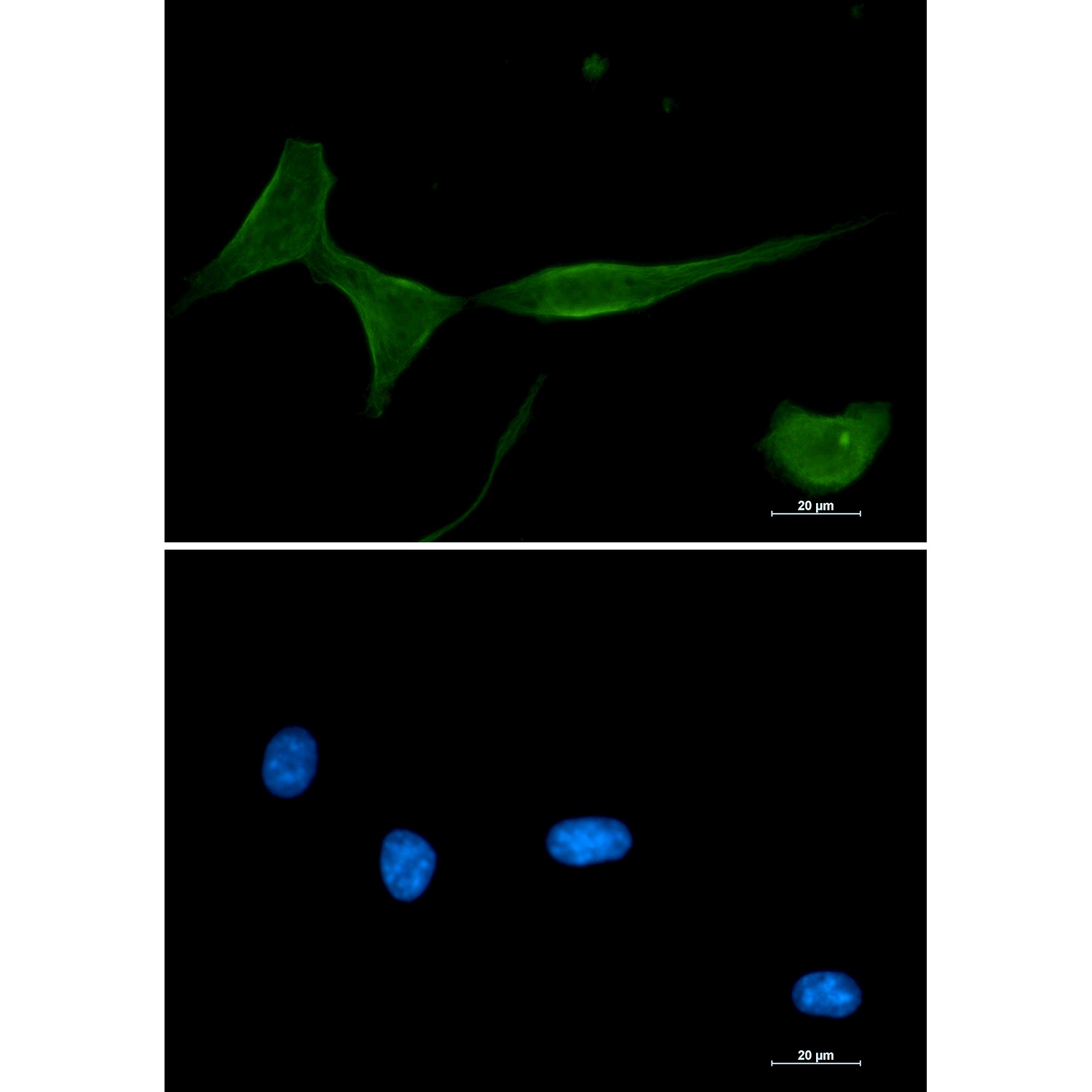 [KD] PKC delta Rabbit mAb