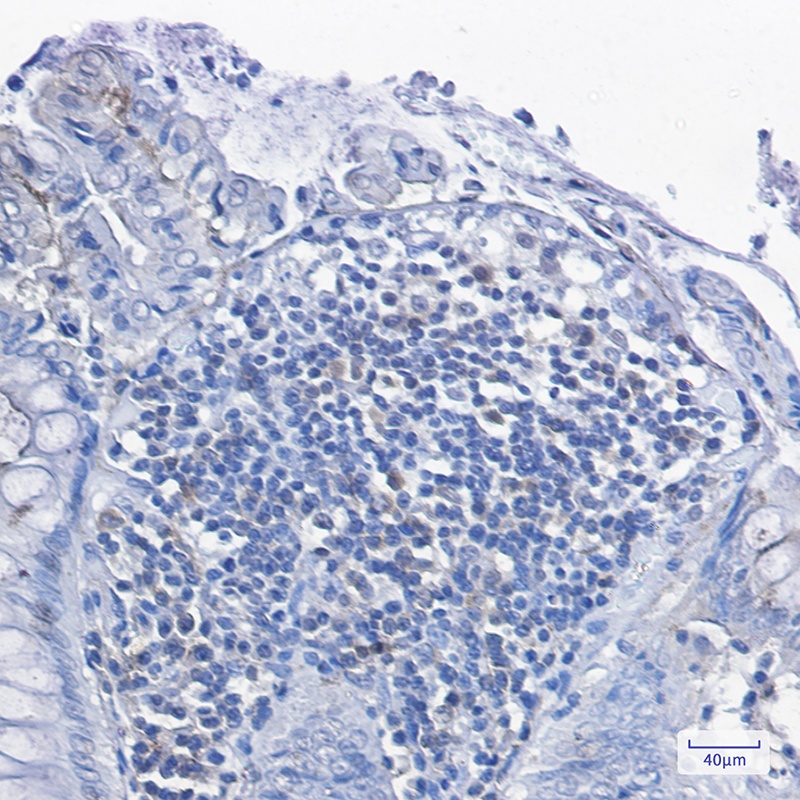[KD] PKC delta Rabbit mAb