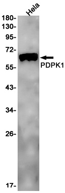 [KO] PDPK1 Rabbit mAb