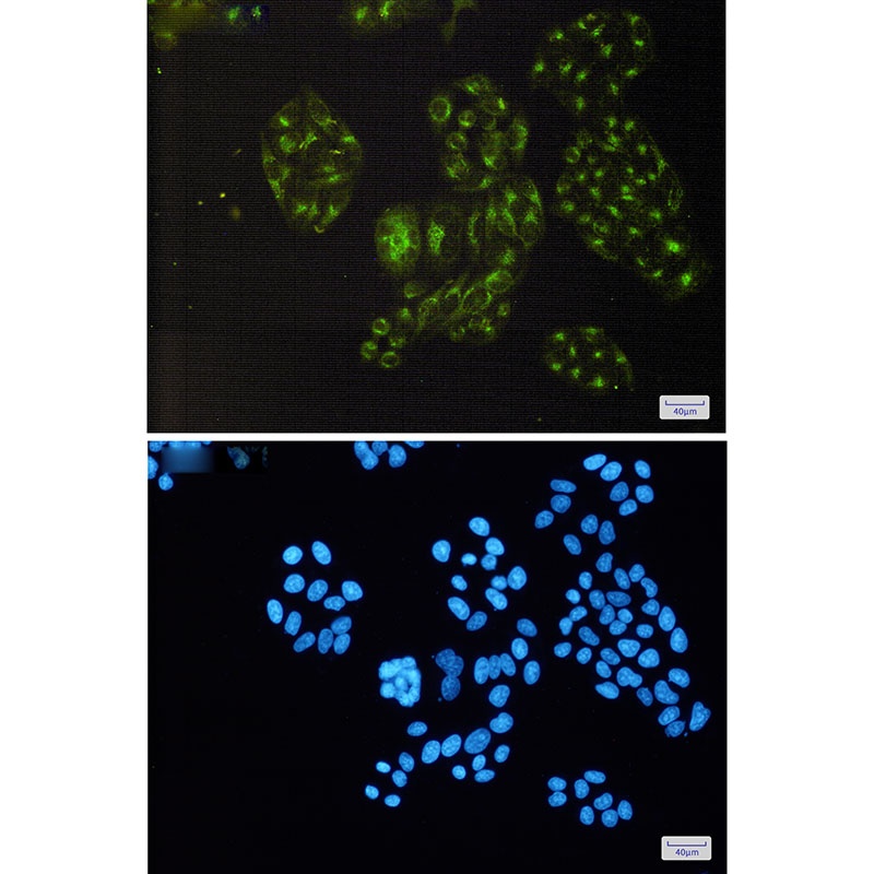 PDLIM1 Antibody