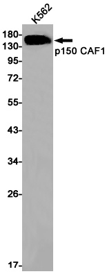[KD] p150 CAF1 Rabbit mAb
