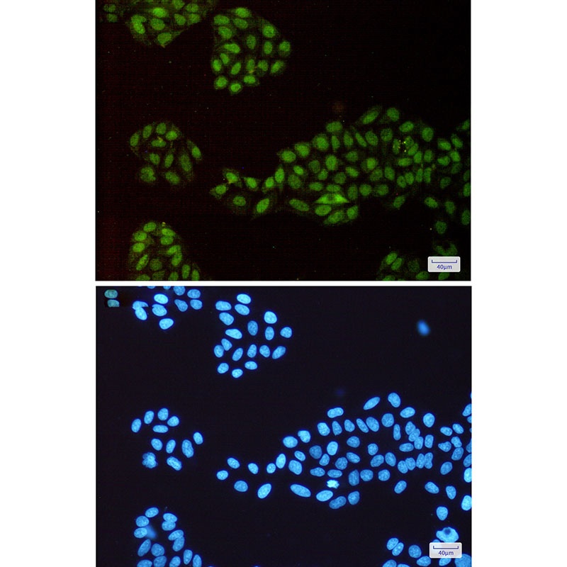 [KD] p150 CAF1 Rabbit mAb