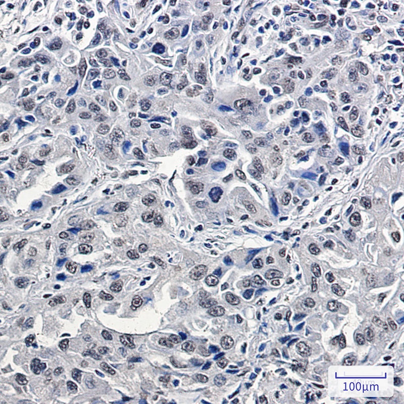 [KD] p150 CAF1 Rabbit mAb