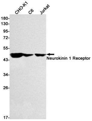 Neurokinin 1 Receptor Rabbit Monoclonal Antibody