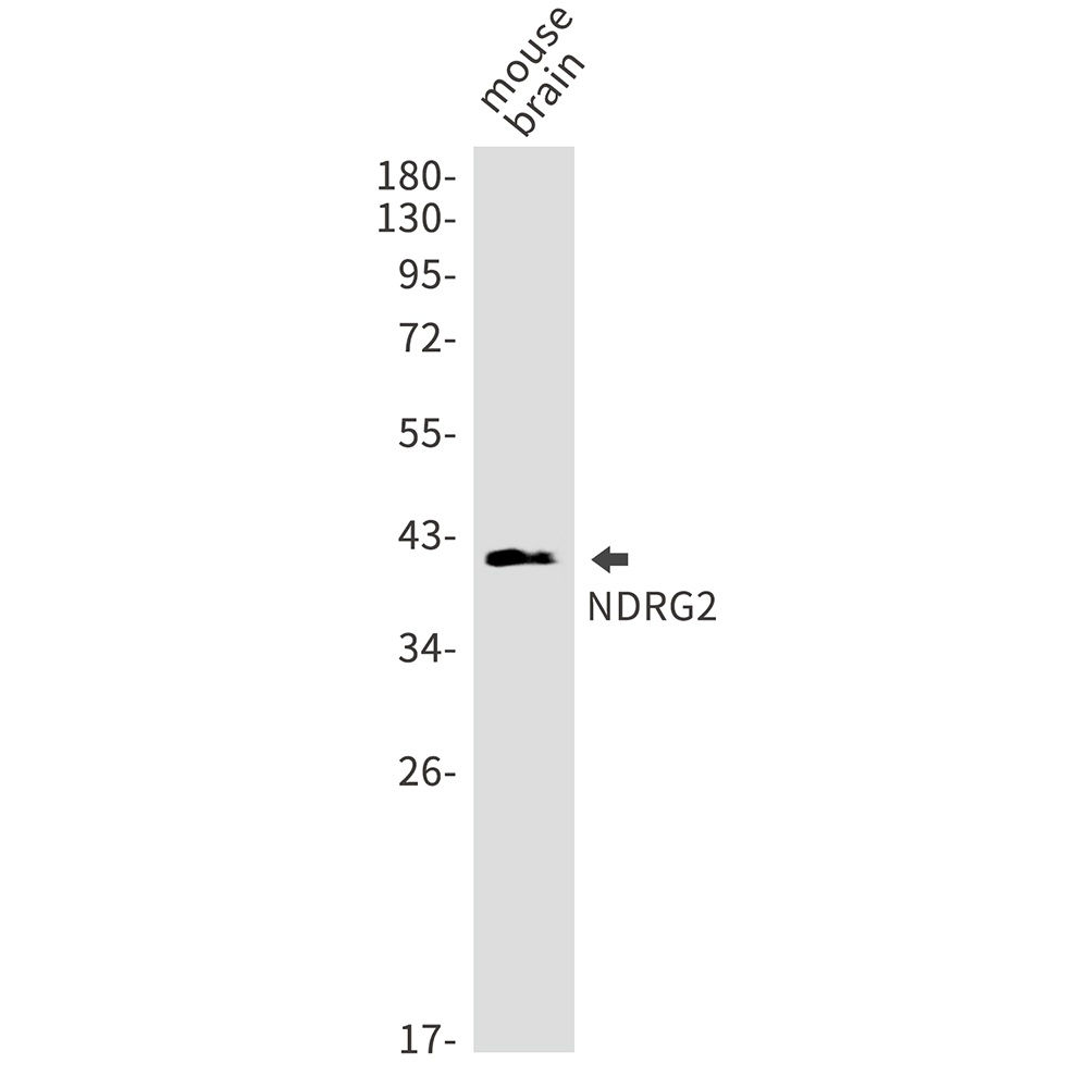 NDRG2 Rabbit Monoclonal Antibody
