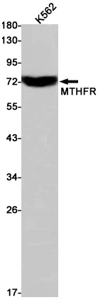 MTHFR Rabbit mAb