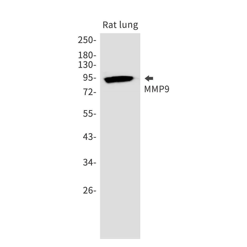 Mmp9 Antibody
