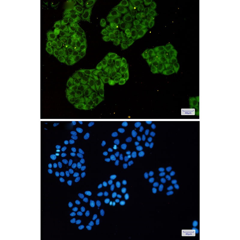 MetRS Rabbit mAb