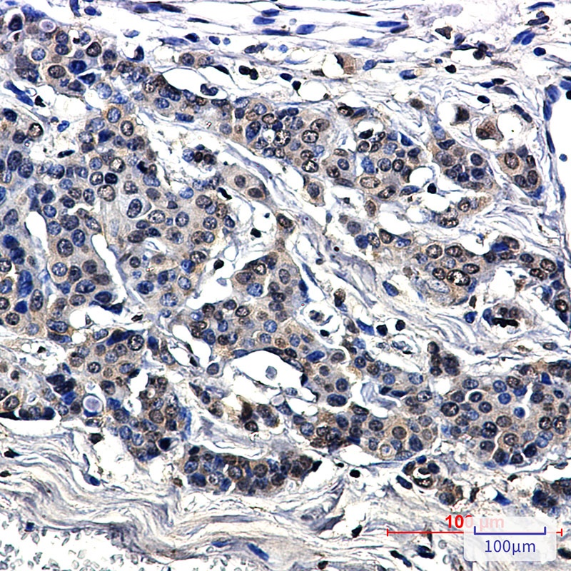 MetRS Rabbit mAb