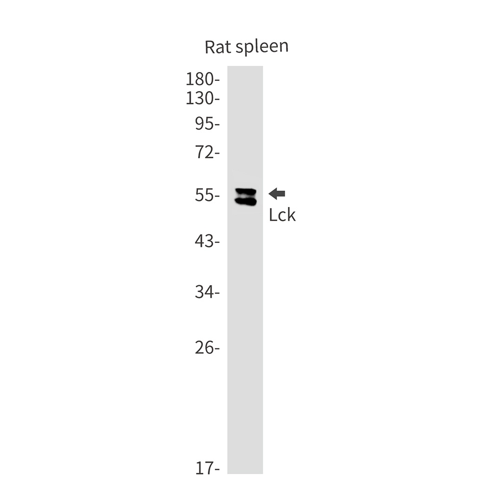 Lck Rabbit Monoclonal Antibody