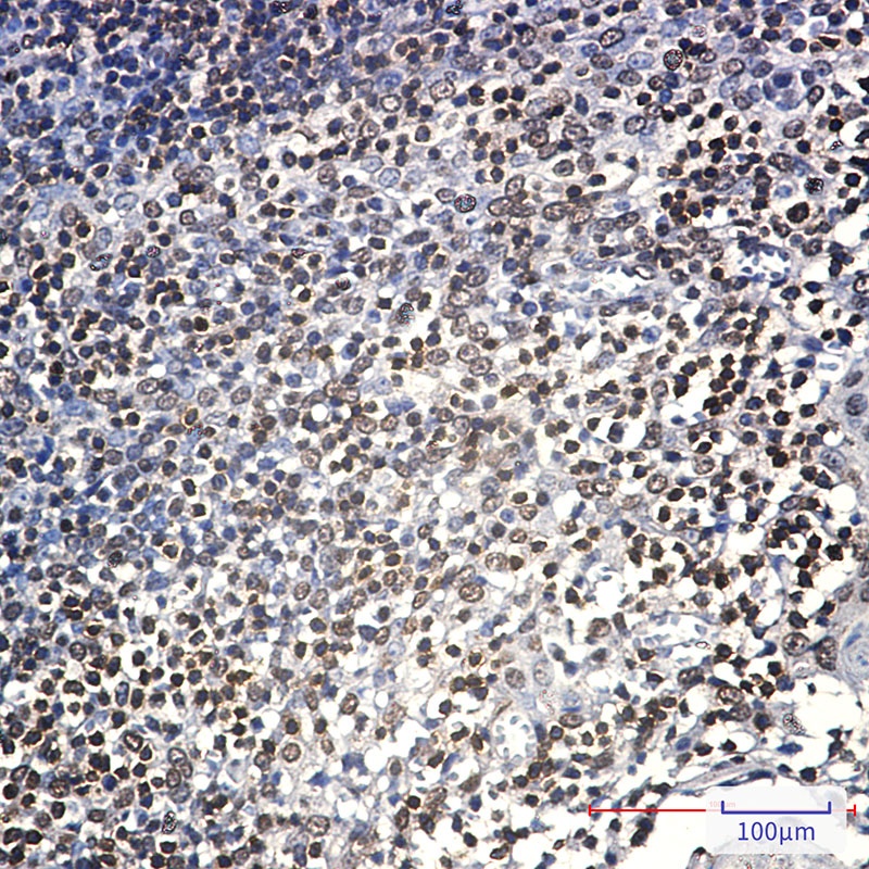 Lck Rabbit Monoclonal Antibody