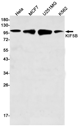 KIF5B Rabbit Monoclonal Antibody