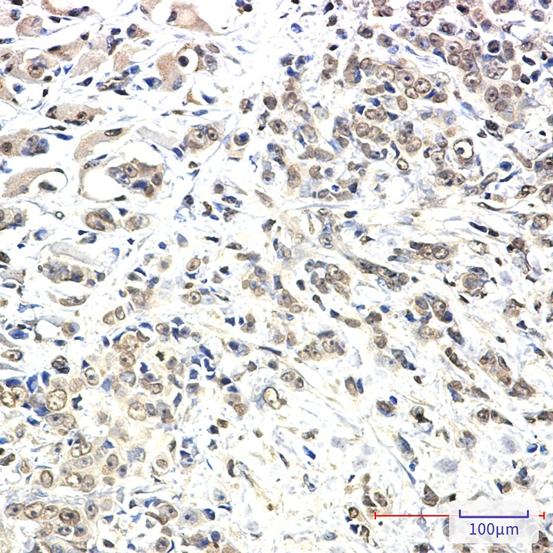 KIF5B Rabbit Monoclonal Antibody