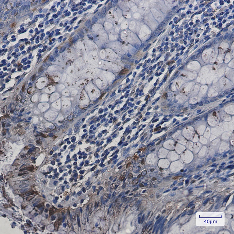 HspA2 Rabbit mAb