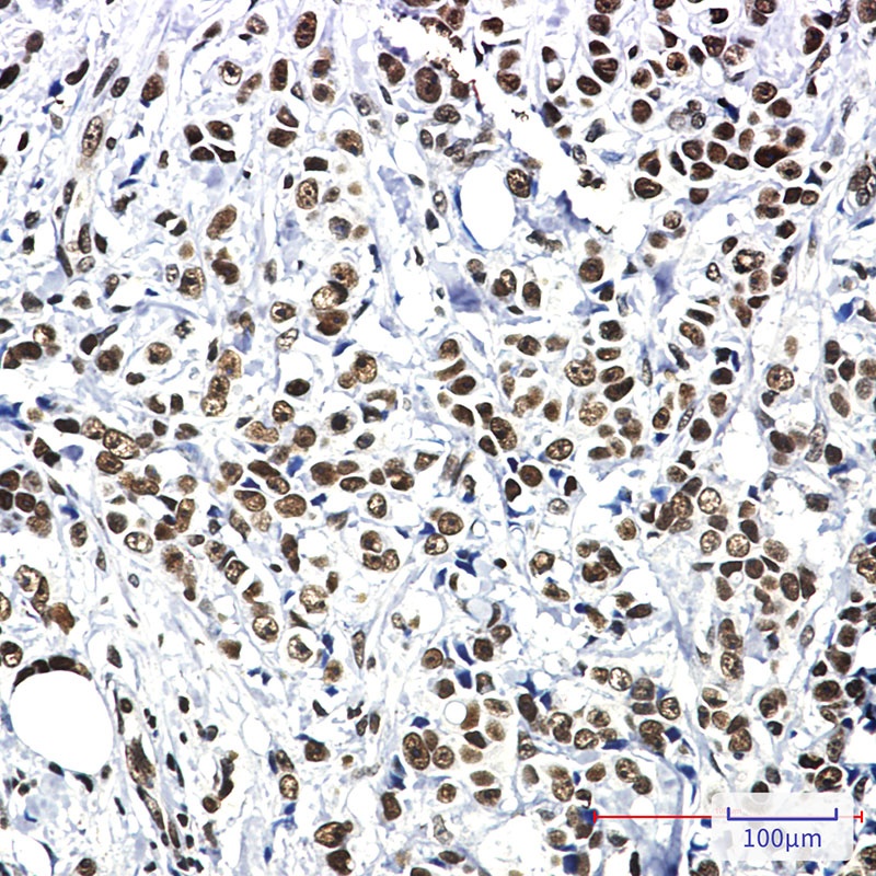 [KO] Hsf1 Rabbit mAb