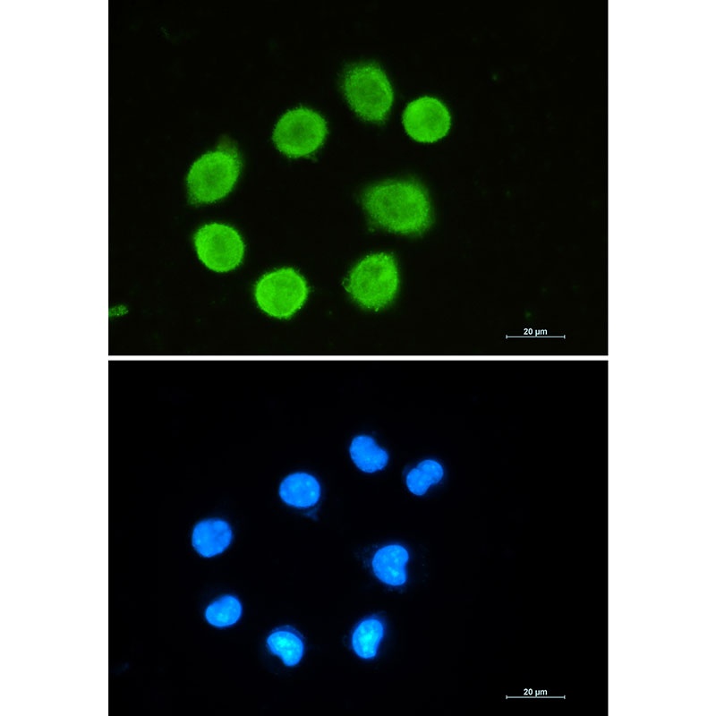 GAP43 Rabbit Monoclonal Antibody